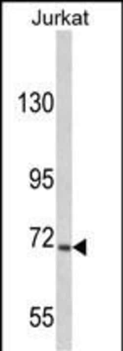 Invitrogen USP19 Polyclonal Antibody 400 &mu;L | Buy Online | Invitrogen&trade; | Fisher Scientific