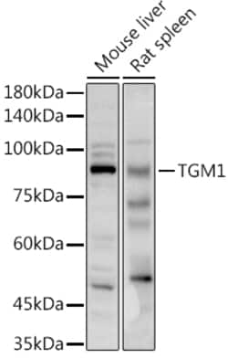 Invitrogen TGM1 Polyclonal Antibody 100 &mu;L; Unconjugated:Antibodies,