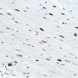 TEF1 Polyclonal Antibody, Invitrogen 100 &mu;L; Unconjugated:Antibodies,