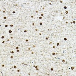 TEF1 Polyclonal Antibody, Invitrogen 100 &mu;L; Unconjugated:Antibodies,