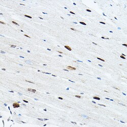 TEF1 Polyclonal Antibody, Invitrogen 100 &mu;L; Unconjugated:Antibodies,
