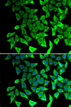 Invitrogen PTGES2 Polyclonal Antibody 100 μL; Unconjugated:Antibodies,