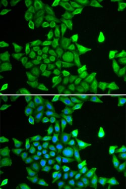 Invitrogen PSMA6 Polyclonal Antibody 100 &mu;L; Unconjugated:Antibodies,