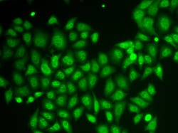 Invitrogen AKR1A1 Polyclonal Antibody 100 &mu;L; Unconjugated:Antibodies,