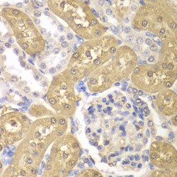 Invitrogen AKR1A1 Polyclonal Antibody 100 &mu;L; Unconjugated:Antibodies,