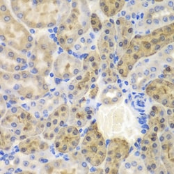 Invitrogen AKR1A1 Polyclonal Antibody 100 &mu;L; Unconjugated:Antibodies,