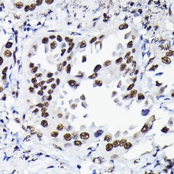 Invitrogen HDGF Polyclonal Antibody 100 &mu;L | Buy Online | Invitrogen&trade; | Fisher Scientific