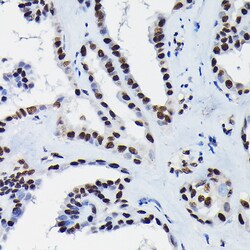Invitrogen HDGF Polyclonal Antibody 100 &mu;L | Buy Online | Invitrogen&trade; | Fisher Scientific