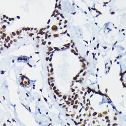 Invitrogen HDGF Polyclonal Antibody 100 &mu;L | Buy Online | Invitrogen&trade; | Fisher Scientific