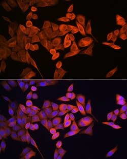Invitrogen RRM1 Polyclonal Antibody 100 &mu;L; Unconjugated:Antibodies,