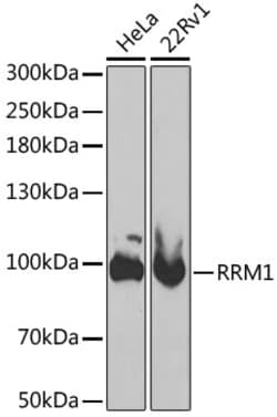 Invitrogen RRM1 Polyclonal Antibody 100 &mu;L; Unconjugated:Antibodies,