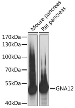 Invitrogen GNA12 Polyclonal Antibody 100 &mu;L; Unconjugated:Antibodies,
