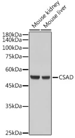 Invitrogen CSAD Polyclonal Antibody 100 &mu;L; Unconjugated:Antibodies,