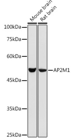 Invitrogen AP2M1 Polyclonal Antibody 100 &mu;L; Unconjugated:Antibodies,