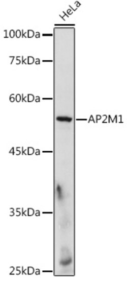 Invitrogen AP2M1 Polyclonal Antibody 100 &mu;L; Unconjugated:Antibodies,