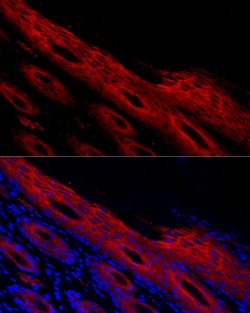 Invitrogen Periplakin Polyclonal Antibody 100 μL; Unconjugated:Antibodies,