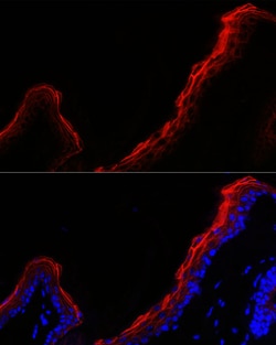 Invitrogen Periplakin Polyclonal Antibody 100 μL; Unconjugated:Antibodies,