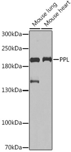 Invitrogen Periplakin Polyclonal Antibody 100 μL; Unconjugated:Antibodies,