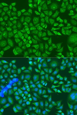 Invitrogen IGF2BP2 Polyclonal Antibody 100 &mu;L; Unconjugated:Antibodies,