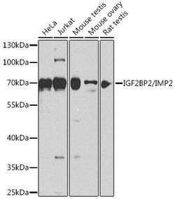 Invitrogen IGF2BP2 Polyclonal Antibody 100 &mu;L; Unconjugated:Antibodies,
