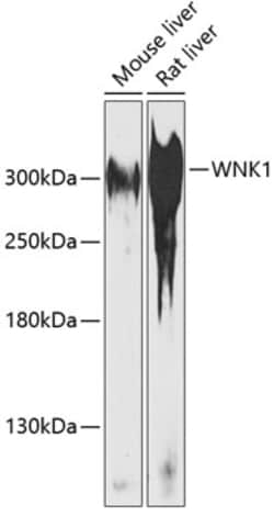 Invitrogen WNK1 Polyclonal Antibody 100 &mu;L; Unconjugated:Antibodies,