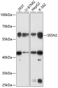 Invitrogen SESN2 Polyclonal Antibody 100 &mu;L | Buy Online | Invitrogen&trade; | Fisher Scientific