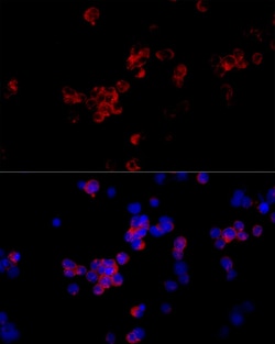 Invitrogen CD299 (DC-SIGN/L) Polyclonal Antibody 100 &mu;L; Unconjugated:Antibodies,