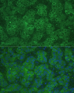 Invitrogen CBS Polyclonal Antibody 100 &mu;L; Unconjugated:Antibodies,