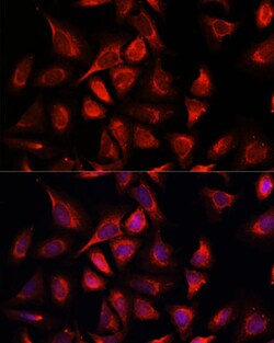 Invitrogen NDUFA4L2 Polyclonal Antibody 100 &mu;L | Buy Online | Invitrogen&trade; | Fisher Scientific