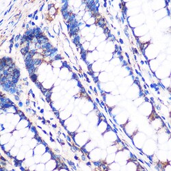 Invitrogen NDUFA4L2 Polyclonal Antibody 100 &mu;L | Buy Online | Invitrogen&trade; | Fisher Scientific