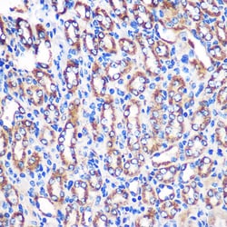 Invitrogen NDUFA4L2 Polyclonal Antibody 100 &mu;L | Buy Online | Invitrogen&trade; | Fisher Scientific