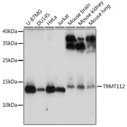 Invitrogen TRMT112 Polyclonal Antibody 100 &mu;L; Unconjugated:Antibodies,