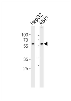 Invitrogen USP22 Polyclonal Antibody 400 &mu;L; Unconjugated:Antibodies,