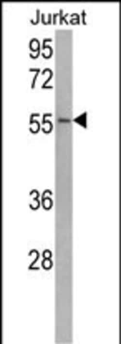 Invitrogen USP22 Polyclonal Antibody 400 &mu;L; Unconjugated:Antibodies,