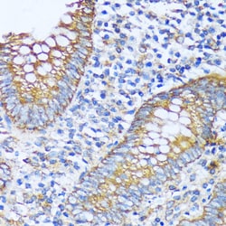Invitrogen ACOT2 Polyclonal Antibody 100 &mu;L; Unconjugated:Antibodies,