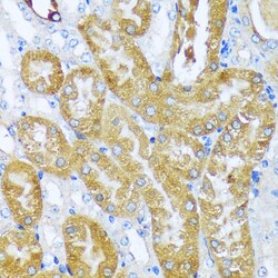 Invitrogen ACOT2 Polyclonal Antibody 100 &mu;L; Unconjugated:Antibodies,