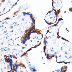 Invitrogen p38 MAPK alpha Polyclonal Antibody 100 &mu;L | Buy Online | Invitrogen&trade; | Fisher Scientific