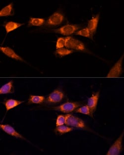 Invitrogen TXNDC12 Polyclonal Antibody 100 μL; Unconjugated:Antibodies,