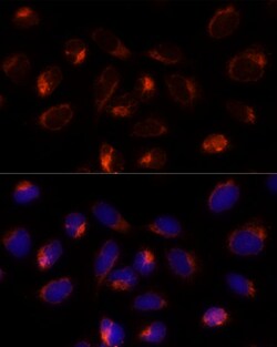 Invitrogen TXNDC12 Polyclonal Antibody 100 μL; Unconjugated:Antibodies,
