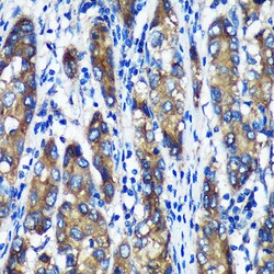 Invitrogen TXNDC12 Polyclonal Antibody 100 μL; Unconjugated:Antibodies,