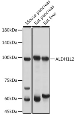 Invitrogen ALDH1L2 Polyclonal Antibody 100 &mu;L; Unconjugated:Antibodies,
