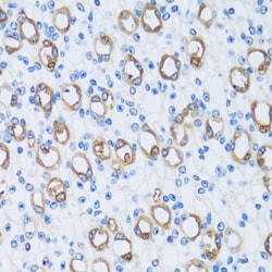 Invitrogen Carbonic Anhydrase XIII Polyclonal Antibody 100 &mu;L; Unconjugated:Antibodies,