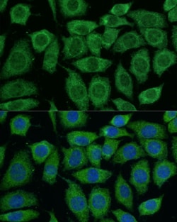 Invitrogen DLAT Polyclonal Antibody 100 &mu;L; Unconjugated:Antibodies,