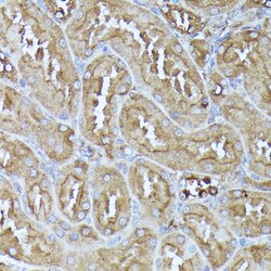 Invitrogen DLAT Polyclonal Antibody 100 &mu;L; Unconjugated:Antibodies,