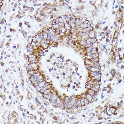 Invitrogen DLAT Polyclonal Antibody 100 &mu;L; Unconjugated:Antibodies,