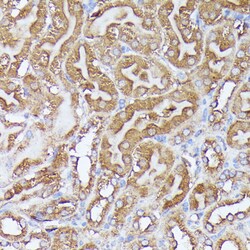 Invitrogen DLAT Polyclonal Antibody 100 &mu;L; Unconjugated:Antibodies,