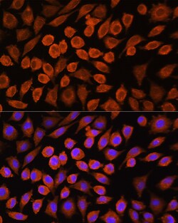 Invitrogen PDP1 Polyclonal Antibody 100 &mu;L; Unconjugated:Antibodies,