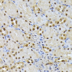 Invitrogen RPS27A Polyclonal Antibody 100 &mu;L; Unconjugated:Antibodies,