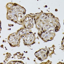Invitrogen RPS27A Polyclonal Antibody 100 &mu;L; Unconjugated:Antibodies,
