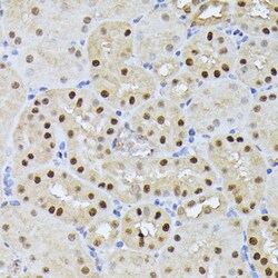 Invitrogen RPS27A Polyclonal Antibody 100 &mu;L; Unconjugated:Antibodies,